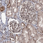 Immunohistochemical staining of human kidney shows strong nuclear positivity in cells in glomeruli.