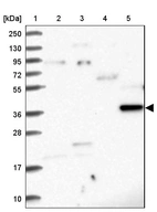 Lane 1: Marker [kDa] 250, 130, 95, 72, 55, 36, 28, 17, 10_br/_Lane 2: Human cell line RT-4_br/_Lane 3: Human cell line U-251MG sp_br/_Lane 4: Human plasma (IgG/HSA depleted)_br/_Lane 5: Human liver tissue