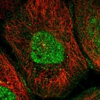 Immunofluorescent staining of human cell line A-431 shows localization to nucleus, nucleoli & cell junctions.