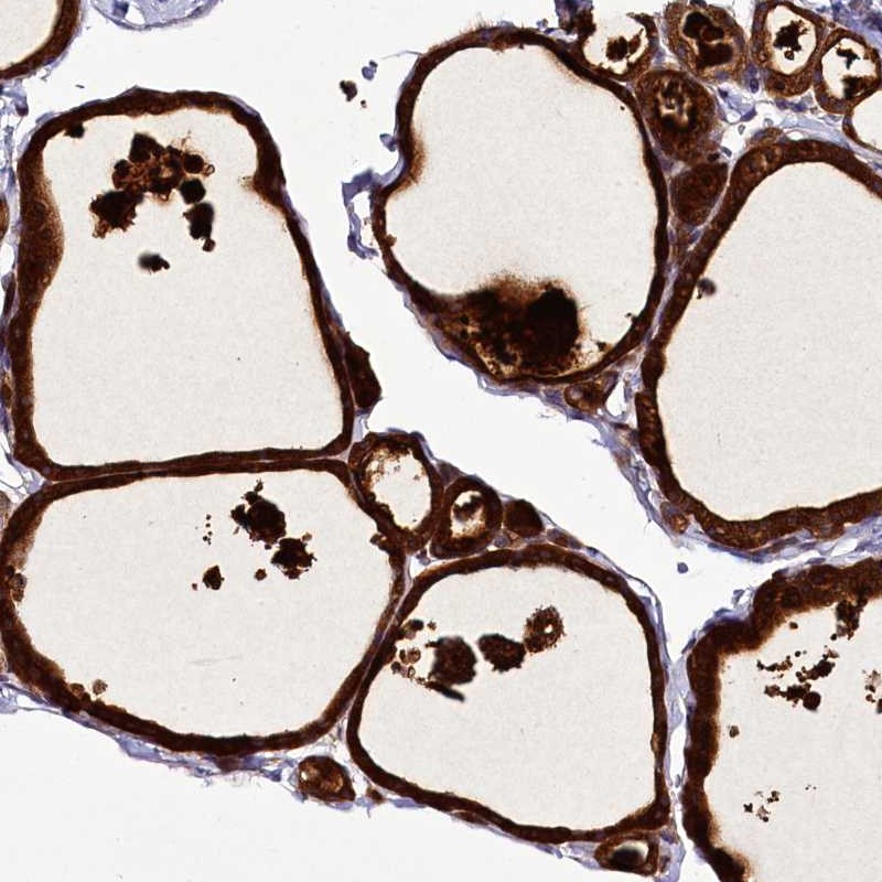 Anti-ZC3H12C Antibody