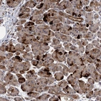 Anti-UBR1 Antibody