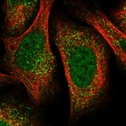 Immunofluorescent staining of human cell line U-2 OS shows localization to nucleoplasm & vesicles.