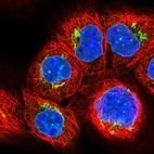 Immunofluorescent staining of human cell line A-431 shows localization to nuclear membrane & the Golgi apparatus.