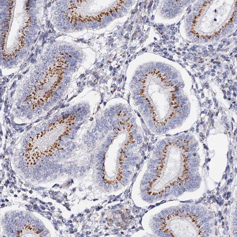 Anti-C11orf96 Antibody