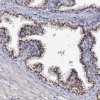 Immunohistochemical staining of human prostate shows strong granular positivity in cytoplasm in glandular cells.
