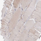 Immunohistochemical staining of human skeletal muscle shows very weak positivity in myocytes.