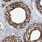 Immunohistochemical staining of human testis shows strong cytoplasmic positivity in cells in seminiferous ducts.