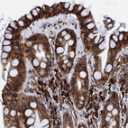 Immunohistochemical staining of human rectum shows strong cytoplasmic positivity in glandular and lymphoid cells.