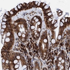 Immunohistochemical staining of human rectum shows strong cytoplasmic positivity in glandular and lymphoid cells.