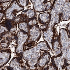 Immunohistochemical staining of human placenta shows strong cytoplasmic positivity in trophoblastic cells.