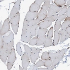 Immunohistochemical staining of human skeletal muscle shows no positivity in striated muscle fibers as expected.