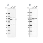 Western blot analysis using Anti-HSPA5 antibody HPA038845 (A) shows similar pattern to independent antibody HPA038846 (B).