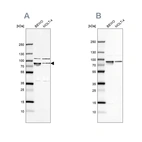 Western blot analysis using Anti-HSPA5 antibody HPA038845 (A) shows similar pattern to independent antibody HPA038846 (B).