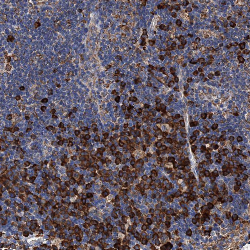 Anti-HSPA5 Antibody