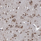 Immunohistochemical staining of human cerebral cortex shows strong cytoplasmic positivity in neurons.