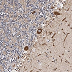 Immunohistochemical staining of human cerebellum shows strong cytoplasmic positivity in purkinje cells.