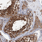 Immunohistochemical staining of human testis shows moderate to strong cytoplasmic positivity in cells in seminiferous ducts.