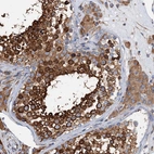 Immunohistochemical staining of human testis shows moderate to strong cytoplasmic positivity in cells in seminiferous ducts.