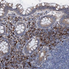 Immunohistochemical staining of human appendix shows strong cytoplasmic positivity in lymphoid cells.