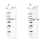 Western blot analysis using Anti-HSPA5 antibody HPA038846 (A) shows similar pattern to independent antibody HPA038845 (B).