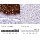 Anti-A2ML1 Antibody