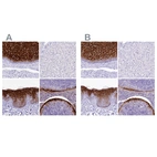 Immunohistochemical staining of human esophagus, liver, skin and tonsil using Anti-A2ML1 antibody HPA038848 (A) shows similar protein distribution across tissues to independent antibody HPA038847 (B).