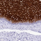 Immunohistochemical staining of human esophagus shows strong cytoplasmic positivity in squamous epithelial cells.