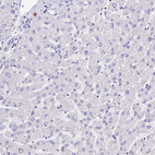 Immunohistochemical staining of human liver shows no positivity in hepatocytes as expected.