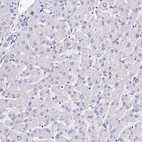 Immunohistochemical staining of human liver shows no positivity in hepatocytes as expected.