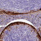 Immunohistochemical staining of human tonsil shows strong cytoplasmic positivity in squamous epithelial cells.