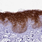 Immunohistochemical staining of human skin shows strong cytoplasmic positivity in epidermal cells.
