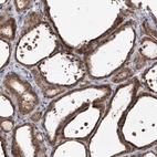 Immunohistochemical staining of human thyroid gland shows high expression.