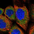 Immunofluorescent staining of human cell line A-431 shows localization to cytosol.