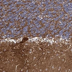 Immunohistochemical staining of human cerebellum shows strong positivity in neuronal processes.