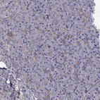 Immunohistochemical staining of human pancreas shows moderate membranous positivity in exocrine glandular cells.