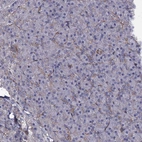 Immunohistochemical staining of human pancreas shows moderate membranous positivity in exocrine glandular cells.
