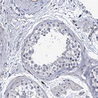 Immunohistochemical staining of human testis shows no membranous positivity in cells in seminiferous ducts as expected.