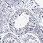 Immunohistochemical staining of human testis shows no membranous positivity in cells in seminiferous ducts as expected.