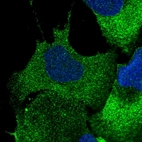 Immunofluorescent staining of human cell line U-2 OS shows positivity in cytoplasm.