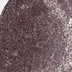 Immunohistochemical staining of human lymph node shows moderate nuclear and cytoplasmic positivity in germinal and non-germinal center cells.