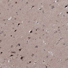 Immunohistochemical staining of human cerebral cortex shows moderate nuclear and cytoplasmic positivity in neurons.