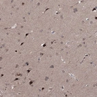 Immunohistochemical staining of human cerebral cortex shows moderate nuclear and cytoplasmic positivity in neurons.