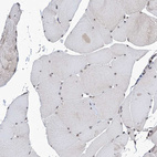 Immunohistochemical staining of human skeletal muscle shows very weak nuclear positivity in myocytes.