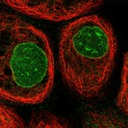 Immunofluorescent staining of human cell line A-431 shows localization to nuclear membrane.