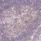 Anti-RBM19 Antibody