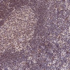 Anti-SCAF11 Antibody