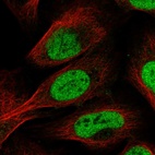 Anti-SCAF11 Antibody