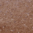 Immunohistochemical staining of human cerebral cortex shows strong positivity in neuropil.