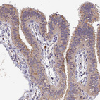 Immunohistochemical staining of human fallopian tube shows moderate cytoplasmic positivity in glandular cells.