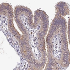 Immunohistochemical staining of human fallopian tube shows moderate cytoplasmic positivity in glandular cells.